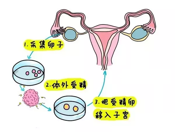 滁州捐卵机构